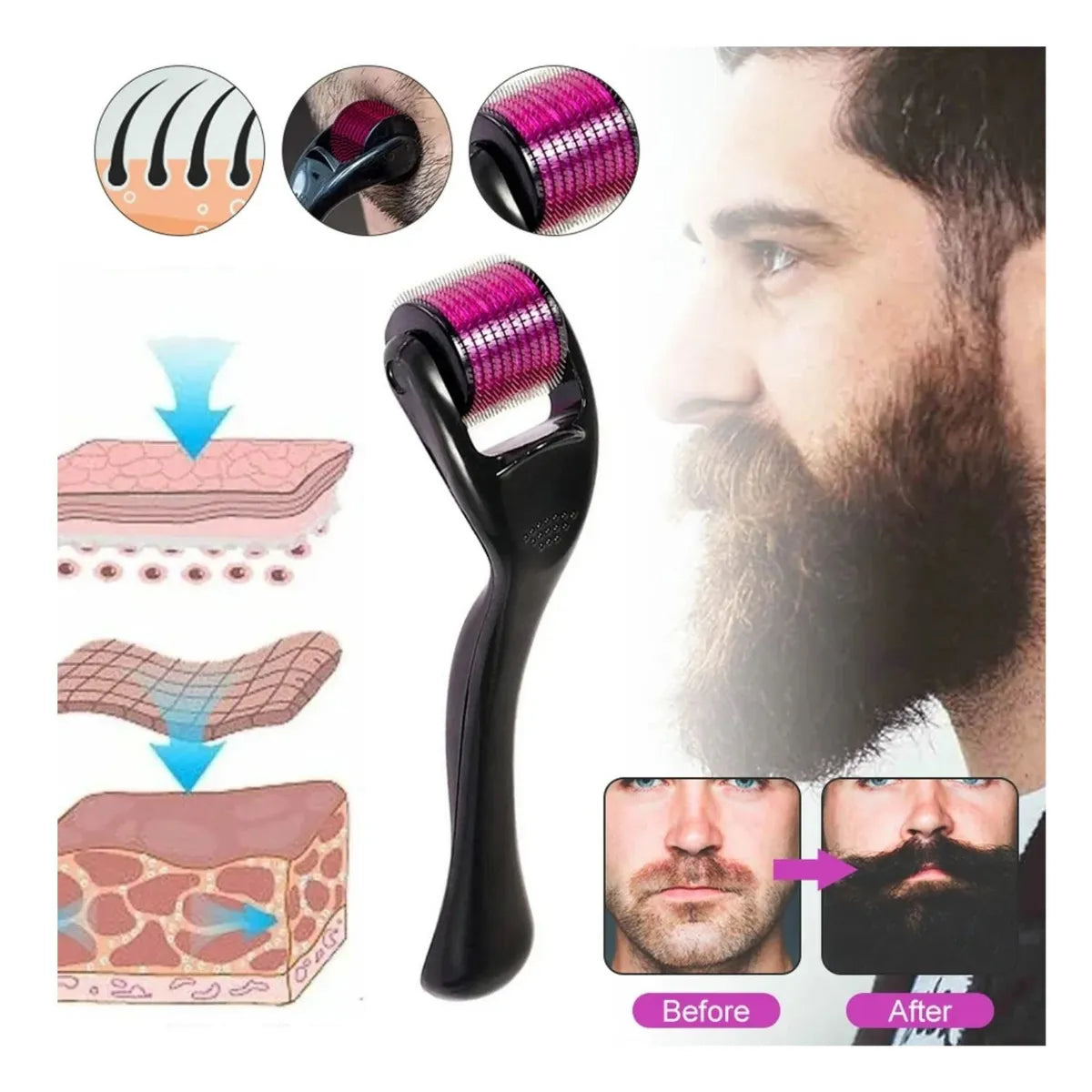 PACK MÁQUINA DE AFEITAR SONAR 3EN1 + DERMA ROLLER